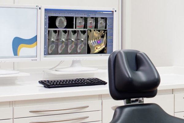 DVT Implantatplanung - ZahnarztAubing Dr. Johannes Stern