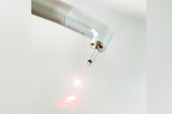 Laserdesinfektion - Wurzelbehandlung - ZahnarztAubing Dr. Johannes Stern, M.Sc. München